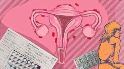 Collage Endometriose 